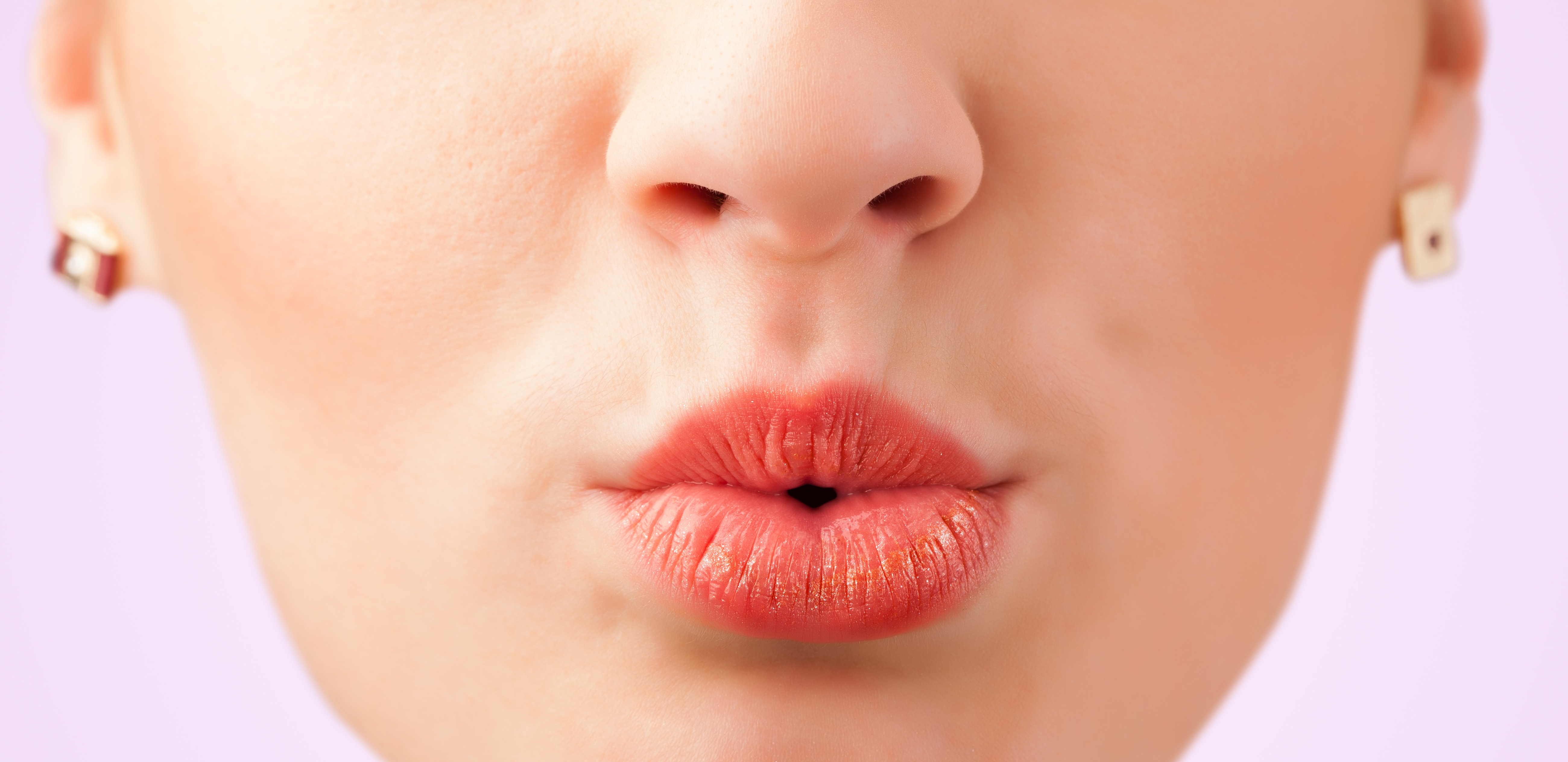 Fix your Lips with SkinCeuticals Antioxidant Lip Repair Essence Laser