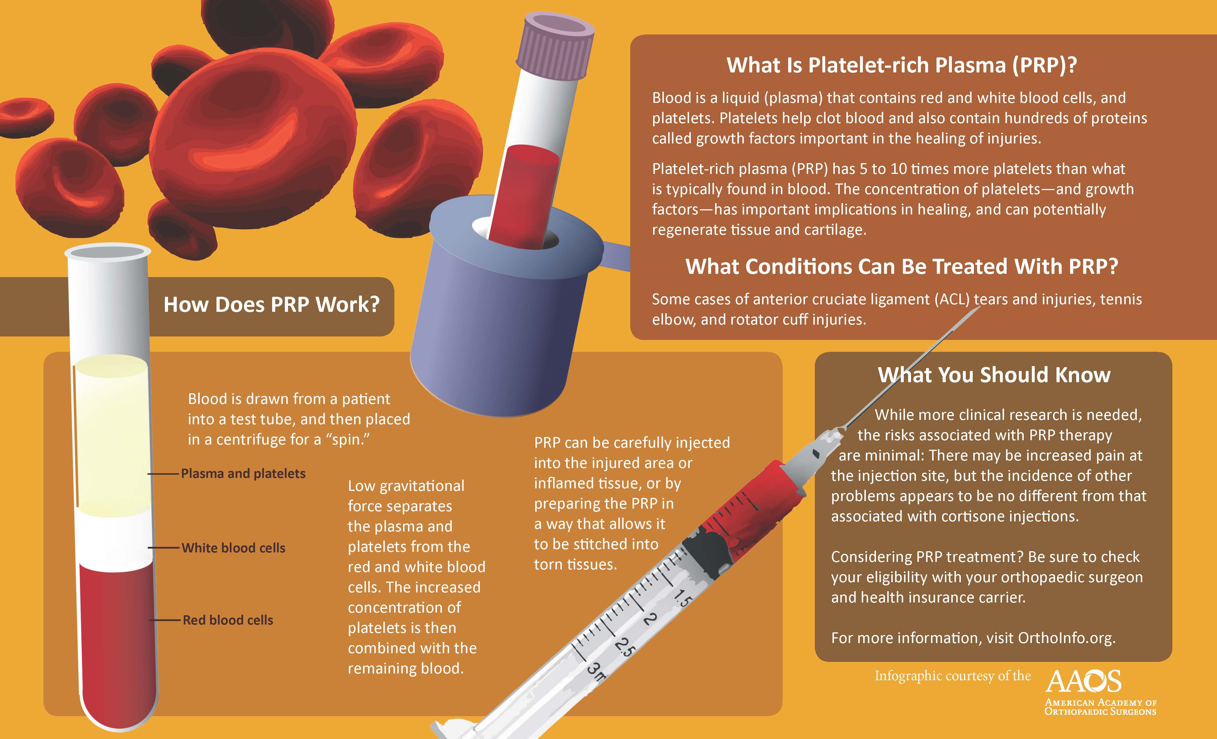 PlateletRichPlasma (PRP) Essence Laser