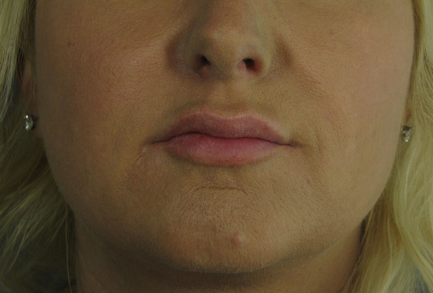 After Image: Vollure - front