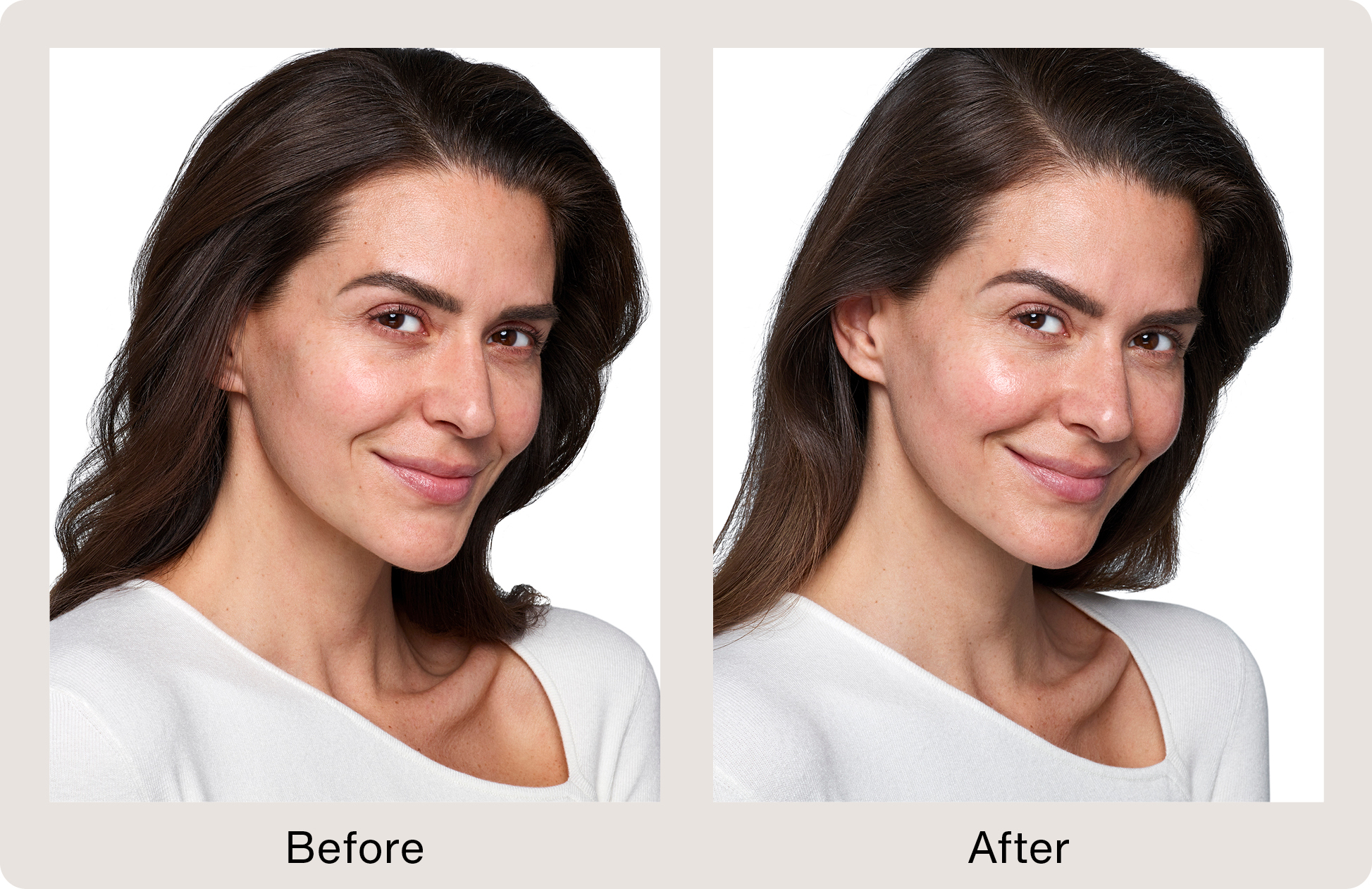 Before and After Image: Skinvive - right-front-oblique