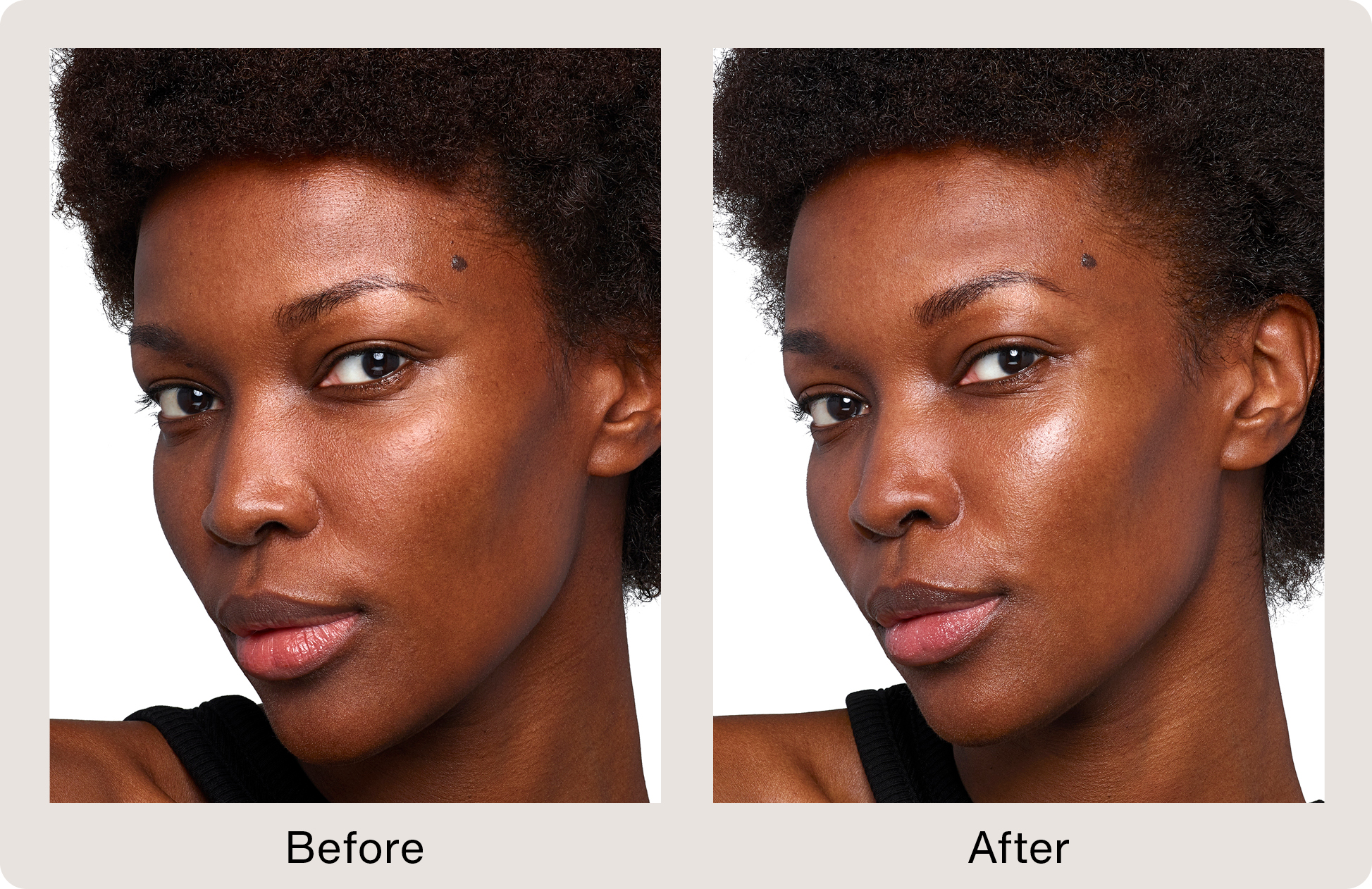 Before and After Image: Skinvive - left-front-oblique