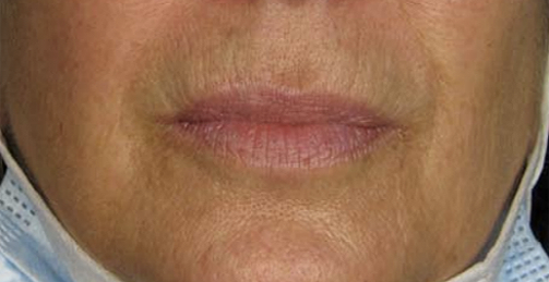After Image: Volbella - front