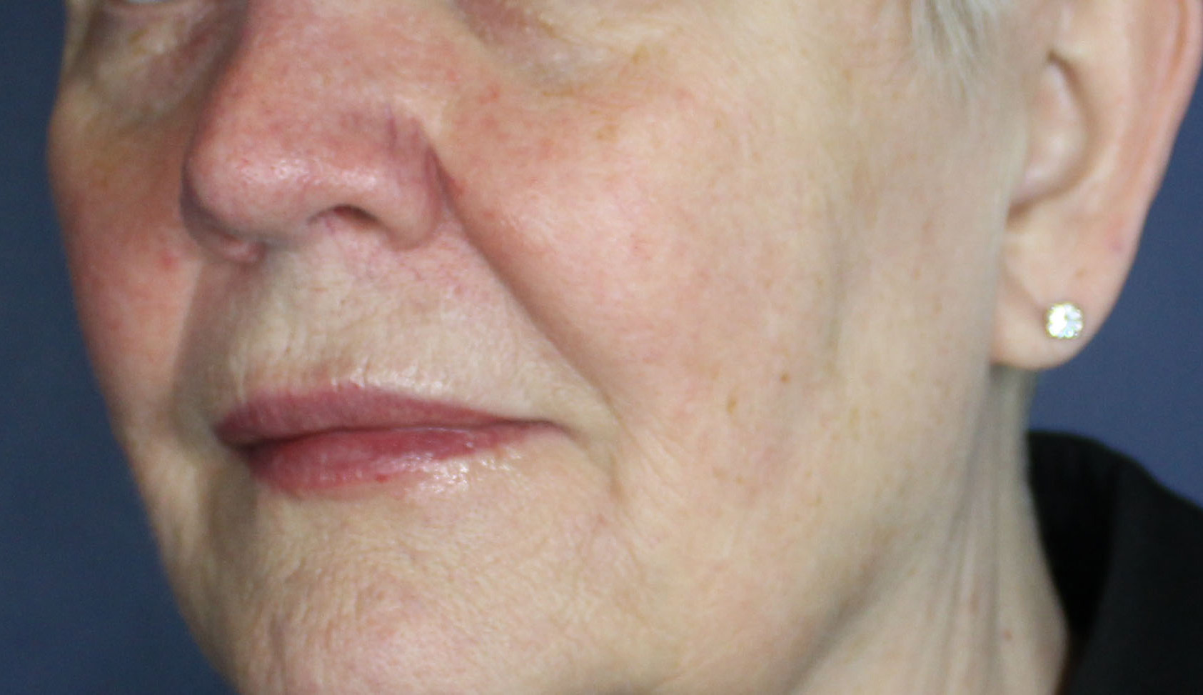 After Image: Voluma XC - left-front-oblique